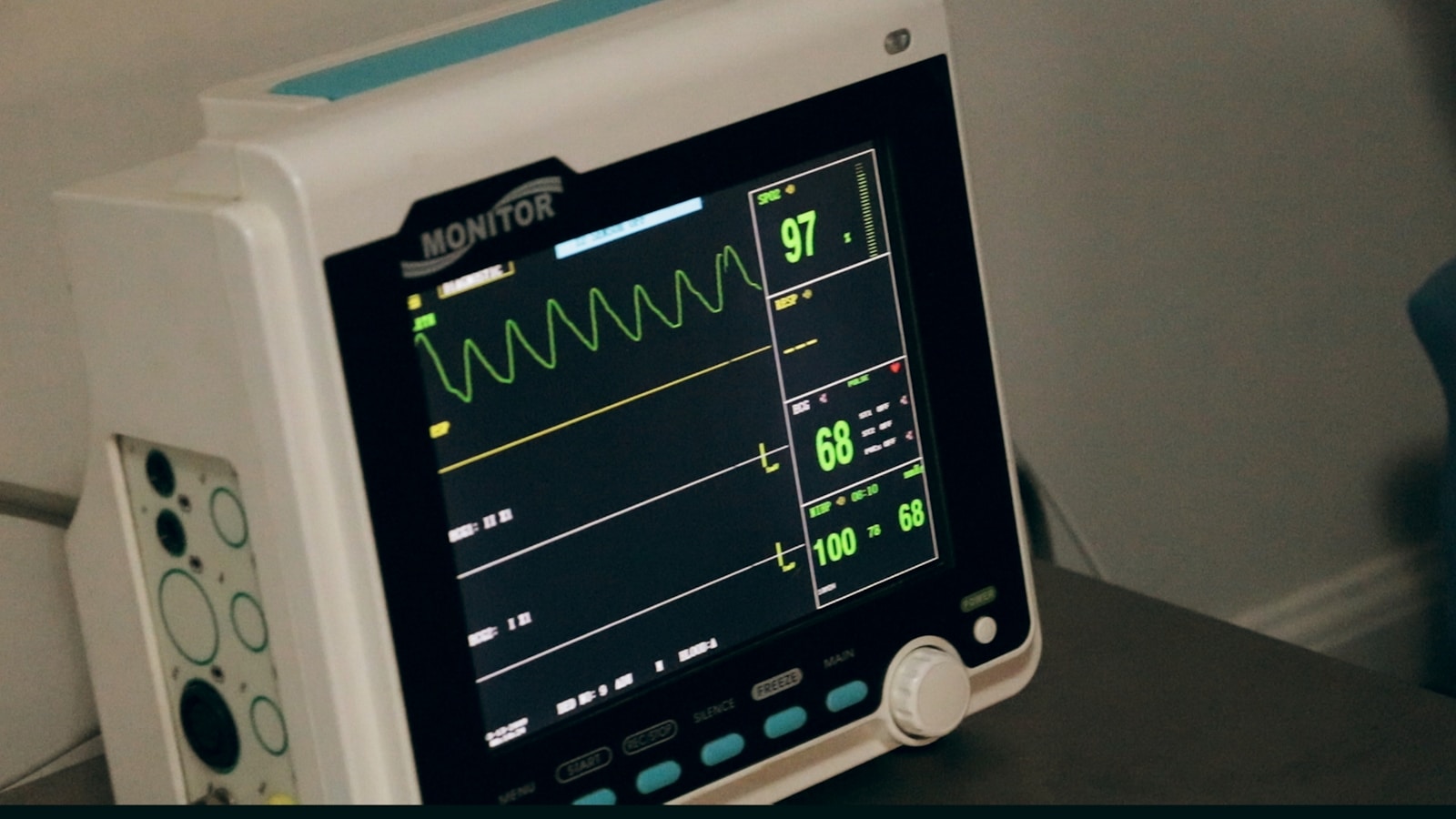 London study exposes big obstacles to implementing artificial intelligence in NHS